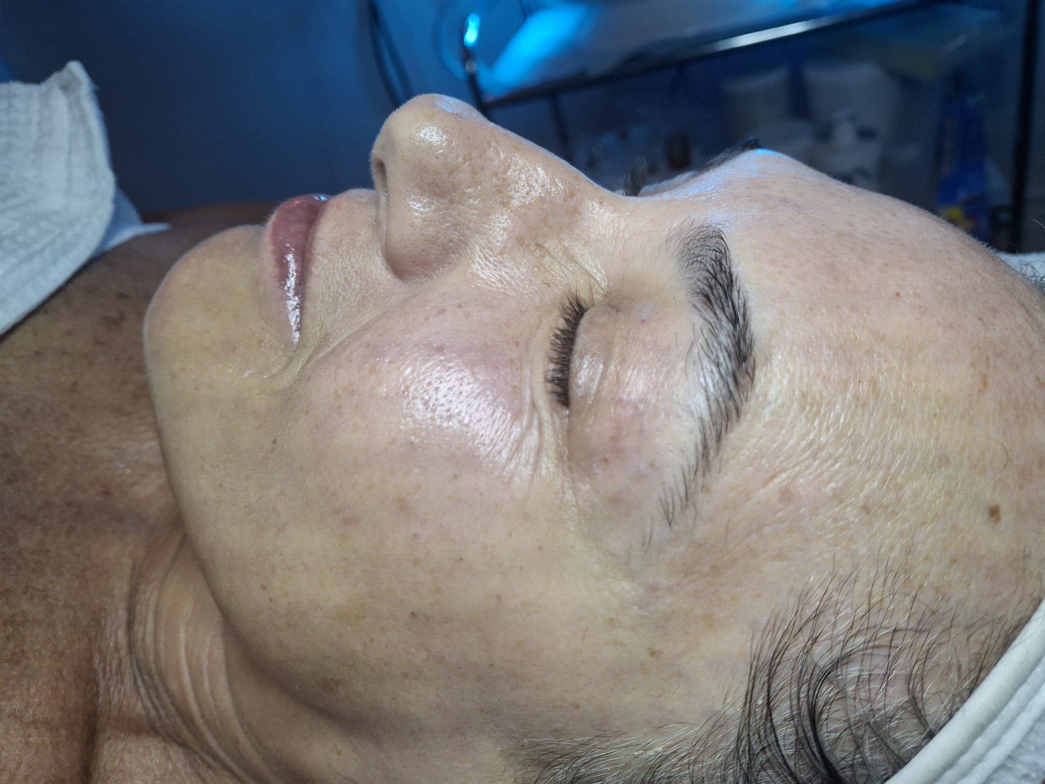After — 1